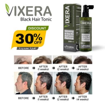 Vixera Black Hair Tonic ad showing 30% off, product bottle and box with before/after hair growth photos.